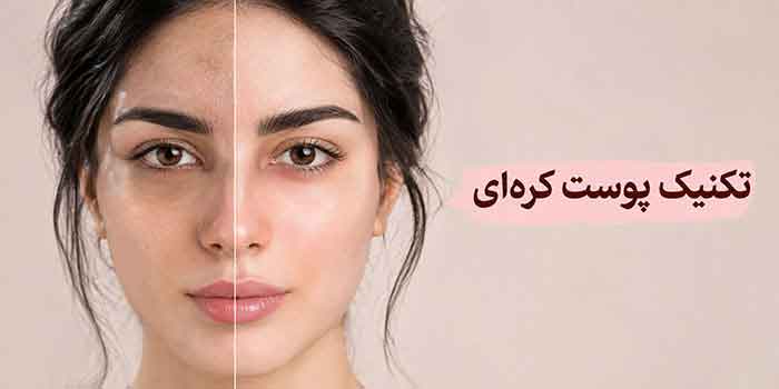 تکنیک پوست کره‌ای چیست؟