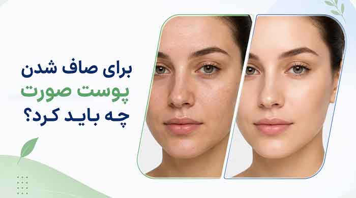 برای صاف شدن پوست صورت چه باید کرد؟